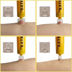 Brand New Venom Extractor Suction Pump Snake Bee Bite Kit Tool For Outdoors USA