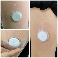 Secure & Comfortable 40 Pack Libre Sensor Protectors – Non-Irritating Adhesive