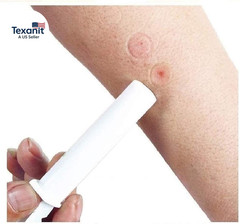 2PK Mosquito Bee Sting Bug Bite Kit Suction Tool Safety Supplies Natural First A